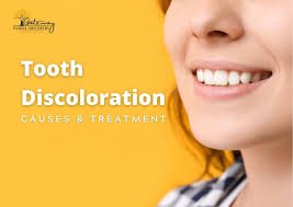 How Dental Crowns Can Address Tooth Discoloration and Staining